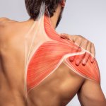 Upper back pain between shoulder blades with highlighted muscle illustration